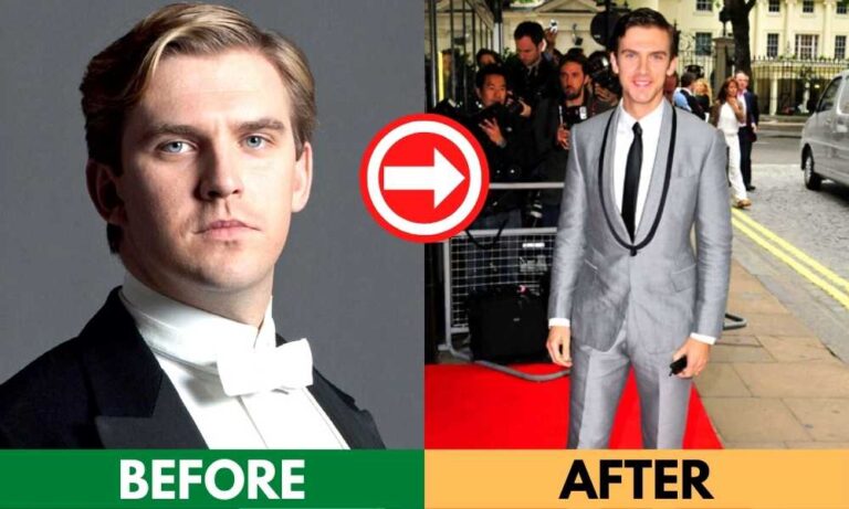 Dan Stevens Weight Loss before and after