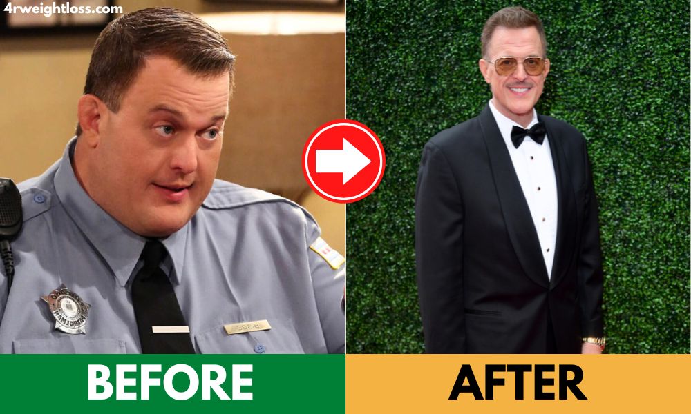 billy gardell weight loss before and after photos