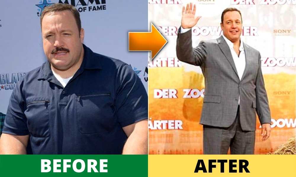 Kevin James Weight Loss before and after photos