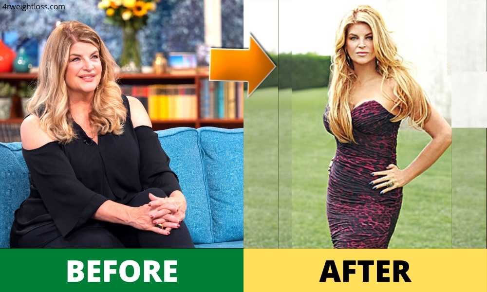 Kirstie Alley Weight Loss 2022 : Diet, Surgery, Before & After Photos