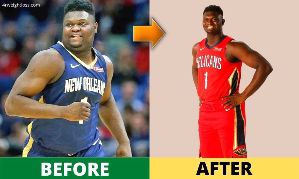 Zion Williamson Weight Loss before and after photos