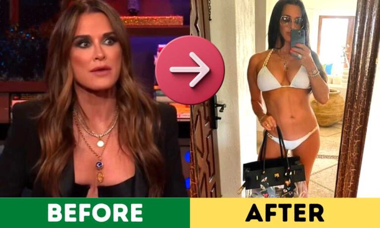 Kyle Richards weight loss before and after pictures