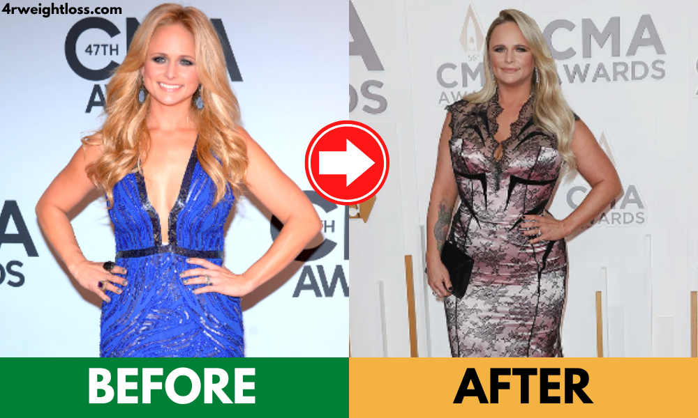 Miranda Lambert Weight Gain Before and After Photos